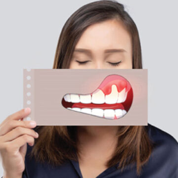 Decoding Gum Disease: Unveiling Symptoms and Causes