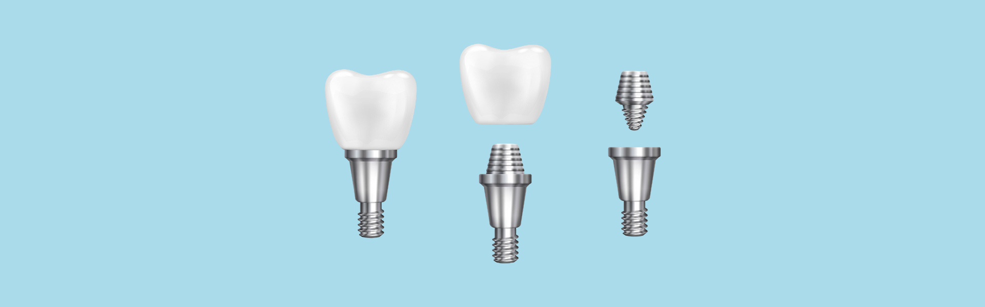 Why Are Dental Implants Considered a Long-Term Solution?